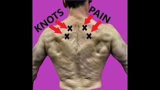 Rhomboid Pain Relief Exercises To Fix Your Upper Back [upl. by Eniala934]