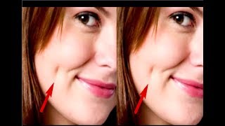 how to get dimples in 5 minutes [upl. by Ydisac]