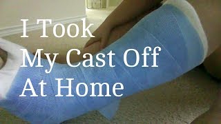 My Life  How To Remove Your Cast At Home [upl. by Berni]