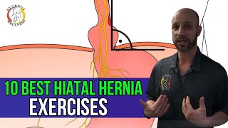 Hiatal Hernia Types Symptoms amp Treatment [upl. by Eelreveb]