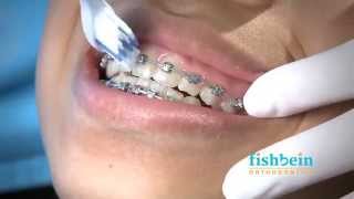 Orthodontic Home Care Instructions  Braces  Brushing [upl. by Rosse]