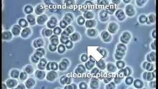 Live Blood Microscopy Demonstration Part 1 [upl. by Annayi]