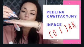 PEELING KAWITACYJNY InFace  test recenzja jak używać [upl. by Homans697]