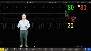 Philips IntelliVue Patient Monitoring  3  Main Screen Display [upl. by Esyle]