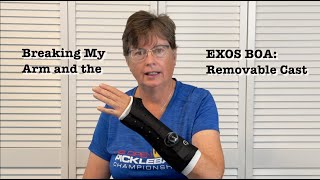 Broken Arm Wrist EXOS BOA Removable Cast — Helpful Tips [upl. by Aldon806]