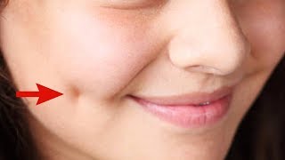 How To Get Dimples Fast And Naturally Beauty Tips [upl. by Katherina]