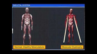 CBSE Class 11 Biology  Skeletal System [upl. by Spaulding263]