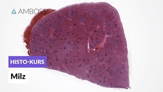 Histologie der Milz  Mikroskopische Anatomie  AMBOSS Video [upl. by Ateinotna]