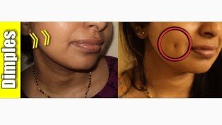 How to Naturally Create Dimples Permanently WITHOUT Surgery [upl. by Abehsile]