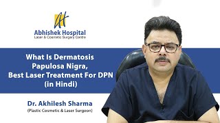 What Is Dermatosis Papulosa Nigra Best Laser Treatment For DPN In Hindi [upl. by Enoitna]