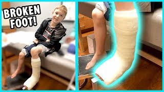 Getting a Cast Jacob Broke His Foot  Part 2 [upl. by Etteb]