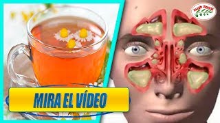 Los 5 mejores remedios para aliviar la sinusitis [upl. by Gill]