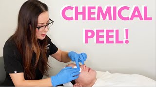 CHEMICAL PEEL AT HOME BEFORE amp AFTER EBANEL SKINCARE [upl. by Judus]