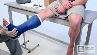 Short Leg Cast  Easy  With Cast Removal [upl. by Garwood]