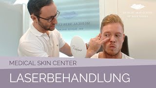 Laserbehandlung im Medical Skin Center – Dr Bacman [upl. by Akenn]