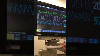 Patient Monitor Instructional Video [upl. by Cassell188]