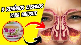 SINUSITE  TOP 3 Receitas Caseiras Para Sinusite sinusite sintomas [upl. by Ojoj]