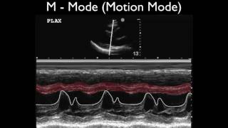 Ultrasound Physics Scanning Modes M Mode [upl. by Teodorico]