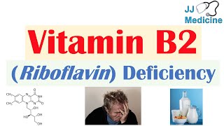 Vitamin B2 Riboflavin Deficiency  Food Sources Causes Symptoms Diagnosis and Treatment [upl. by Portie]