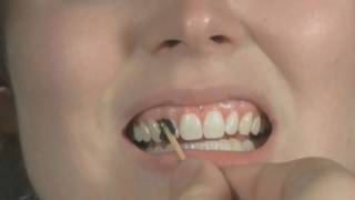 Tooth Wax Tutorial [upl. by Doris]