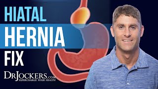 Fix Hernia Naturally [upl. by Georgeta]