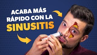 Cómo curar la SINUSITIS más rápido [upl. by Leinto]