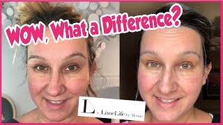 Limelife by Alcone Skincare Review [upl. by Boonie192]