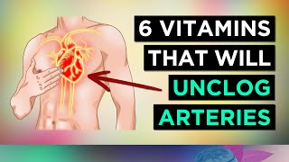 6 Vitamins To UNCLOG Your ARTERIES [upl. by Nosyla]